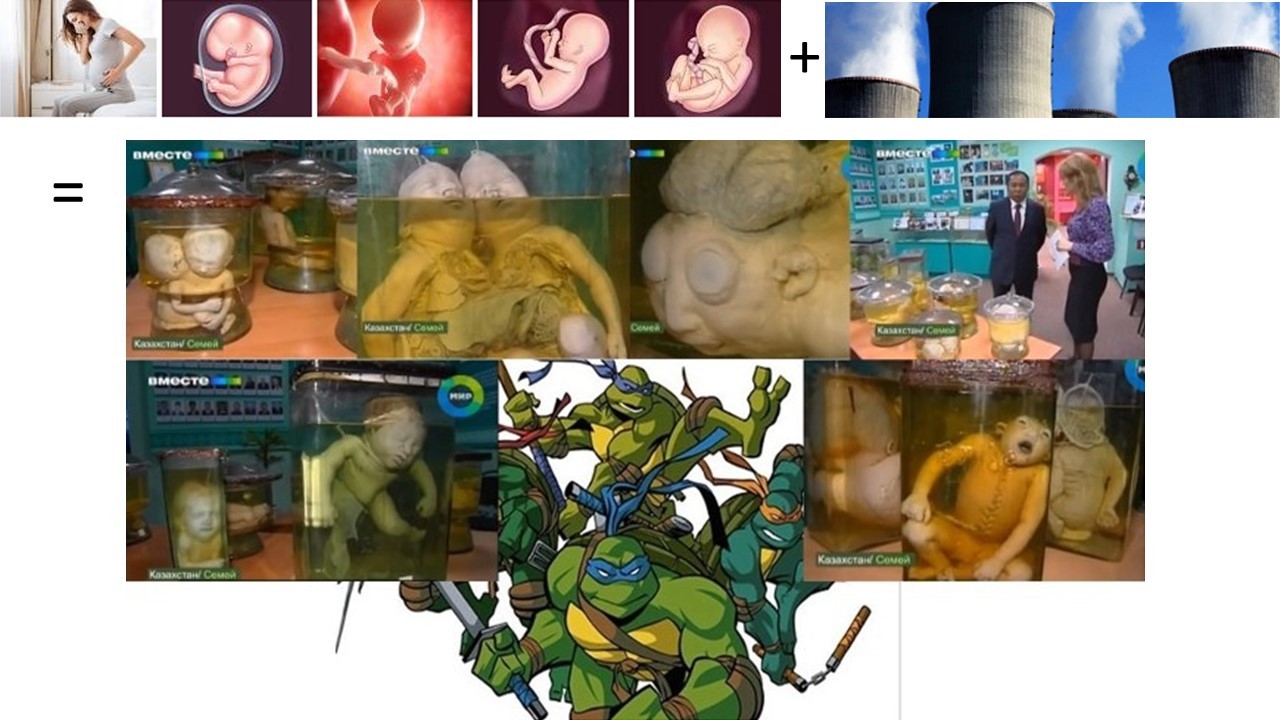 Healthy pregnancies are destroyed by normally operating nuclear reactors. The steam from the stacks is radioactive steam, filled with tritium and other radionuclides. Here we see the results of pregnant women from nuclear test fallout in Kazakhstan. They may not have even been pregnant at the time, because their ova were internally dosed as well as any fetus, or perhaps the sperm of the men was contaminated with nuclear fallout radionuclides.